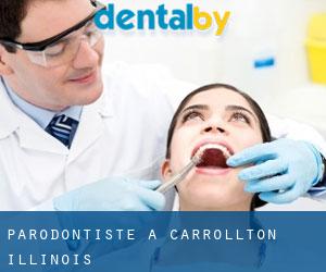 Parodontiste à Carrollton (Illinois)