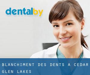Blanchiment des dents à Cedar Glen Lakes