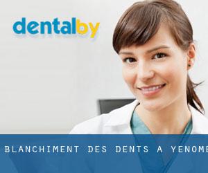 Blanchiment des dents à Yenome