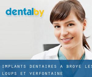Implants dentaires à Broye-les-Loups-et-Verfontaine