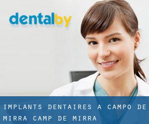 Implants dentaires à Campo de Mirra / Camp de Mirra