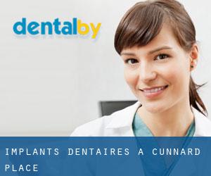 Implants dentaires à Cunnard Place