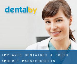 Implants dentaires à South Amherst (Massachusetts)