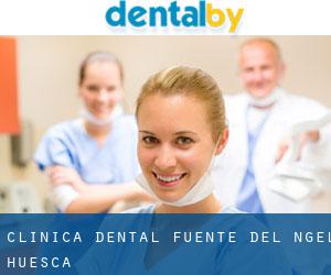 Clínica Dental Fuente del Ángel (Huesca)