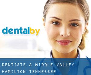 dentiste à Middle Valley (Hamilton, Tennessee)