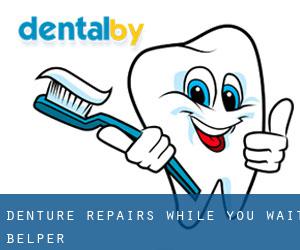 Denture Repairs While You Wait (Belper)